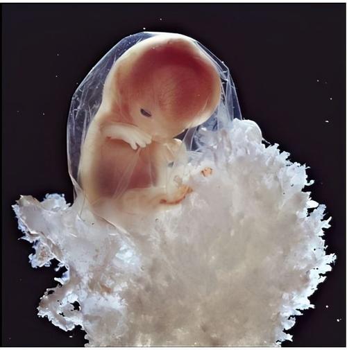 供卵试管代怀包成功【供卵试管代怀包成功：成功孕育新生命的希望】